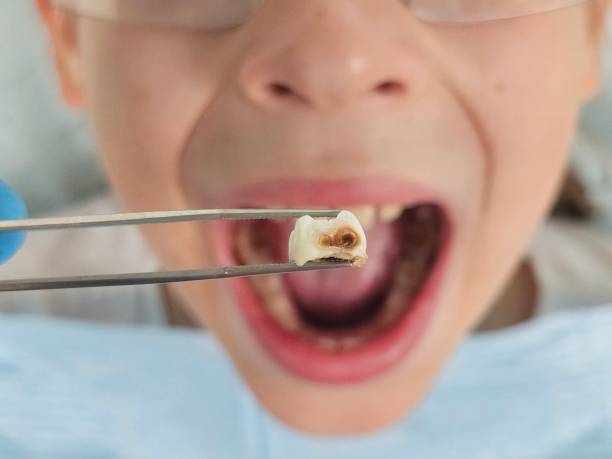 Best Orthodontic Emergency Dentist in Mont Alto, PA